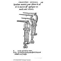 1573-DALECHAMP-Vaginal speculum