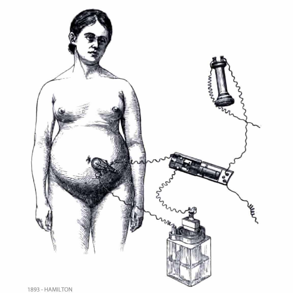 1893-HAMILTON-FHR auscultation with microphone