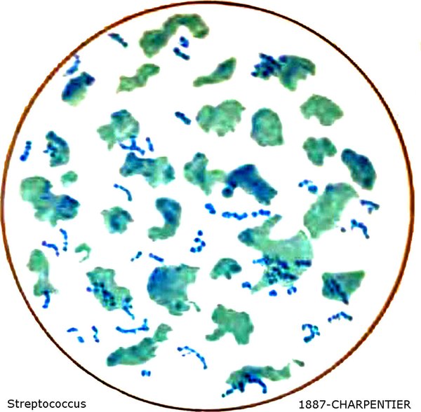 Infection