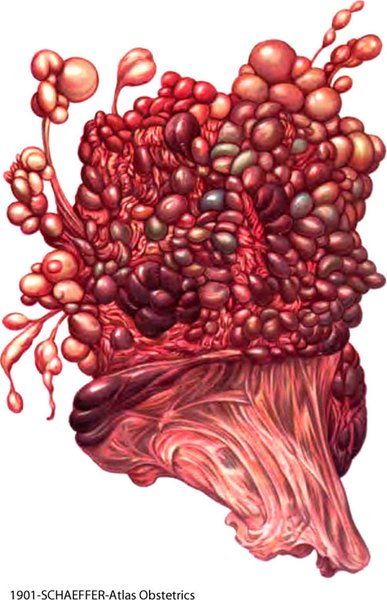Vesicular Mole 1901