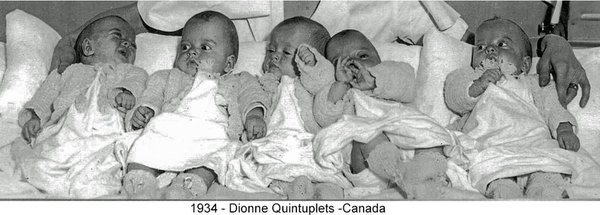1934-Dionne Quintuplets