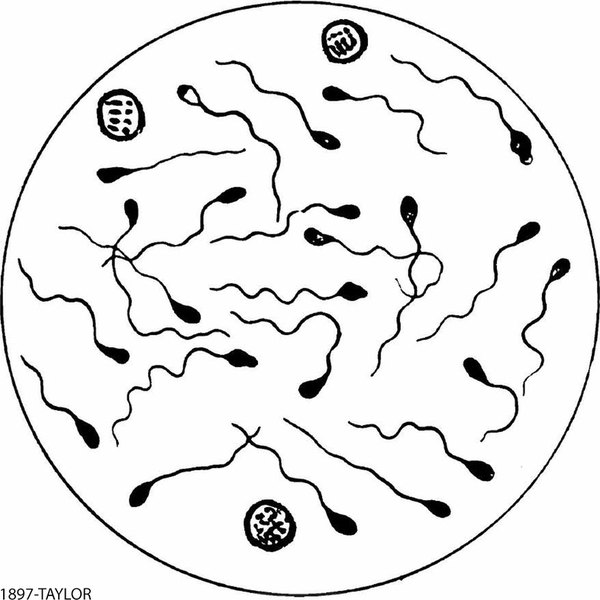 Infertility
