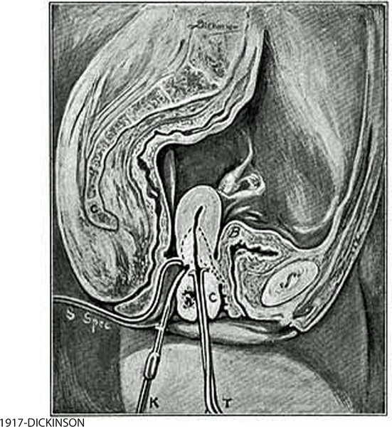 1917