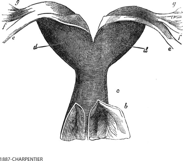Congenital