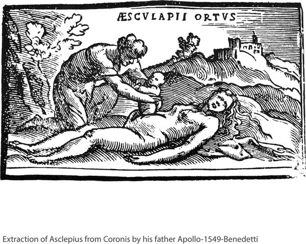 Birth Asclepius