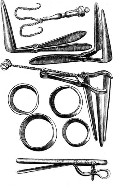 1675-SCULETUS