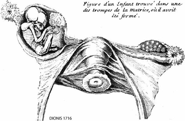 1716-DIONIS