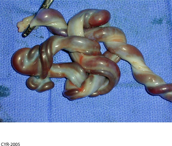 Cord Knot