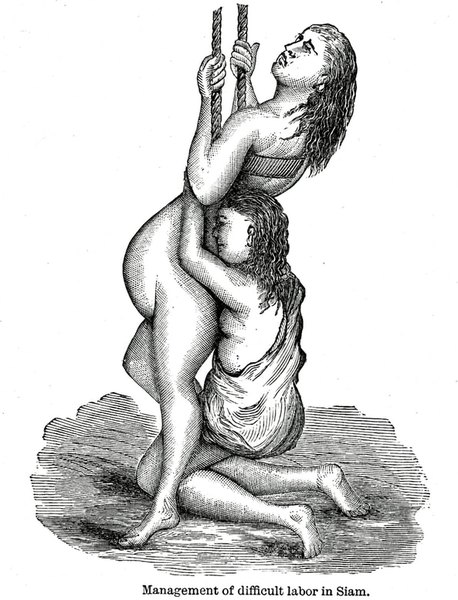 Difficult Birth